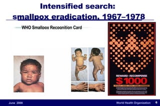 Intensified search:  smallpox eradication, 1967–1978  WHO Smallpox Recognition Card 