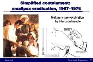 Simplified containment:  smallpox eradication, 1967–1978 Multipuncture vaccination  by bifurcated needle 