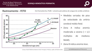 DOENÇA HEMOLÍTICA PERINATAL
portaldeboaspraticas.iff.fiocruz.br
Rastreamento - FETO
• Medidas seriadas do pico
da velocidade da artéria
cerebral média fetal.
• Zona A indica anemia
moderada a severa ( > 1,5
múltiplos de mediana
MoM).
• Zona B indica anemia leve.
Creasy e Resnik Medicina Materno Fetal: Principios e Práticas, cap36, ed Elsevier,2016.
Hct=hematócrito; PUBS = amostra percutânea do sangue do cordão umbilical.
 