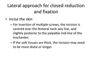 Lateral approach for closed reduction
and fixation
• Incise the skin
– For insertion of multiple screws, the incision is
centred over the femoral neck axis line, and
slightly posterior to the palpable mid line of the
trochanter.
– If the soft tissues are thick, the incision may need
to be more distal or longer.
 