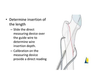 • Determine insertion of
the length
– Slide the direct
measuring device over
the guide wire to
determine wire
insertion depth.
– Calibration on the
measuring device
provide a direct reading
 
