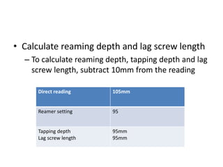 • Calculate reaming depth and lag screw length
– To calculate reaming depth, tapping depth and lag
screw length, subtract 10mm from the reading
Direct reading 105mm
Reamer setting 95
Tapping depth
Lag screw length
95mm
95mm
 
