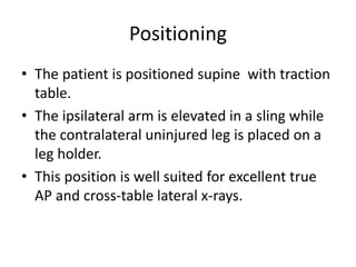 Positioning
• The patient is positioned supine with traction
table.
• The ipsilateral arm is elevated in a sling while
the contralateral uninjured leg is placed on a
leg holder.
• This position is well suited for excellent true
AP and cross-table lateral x-rays.
 