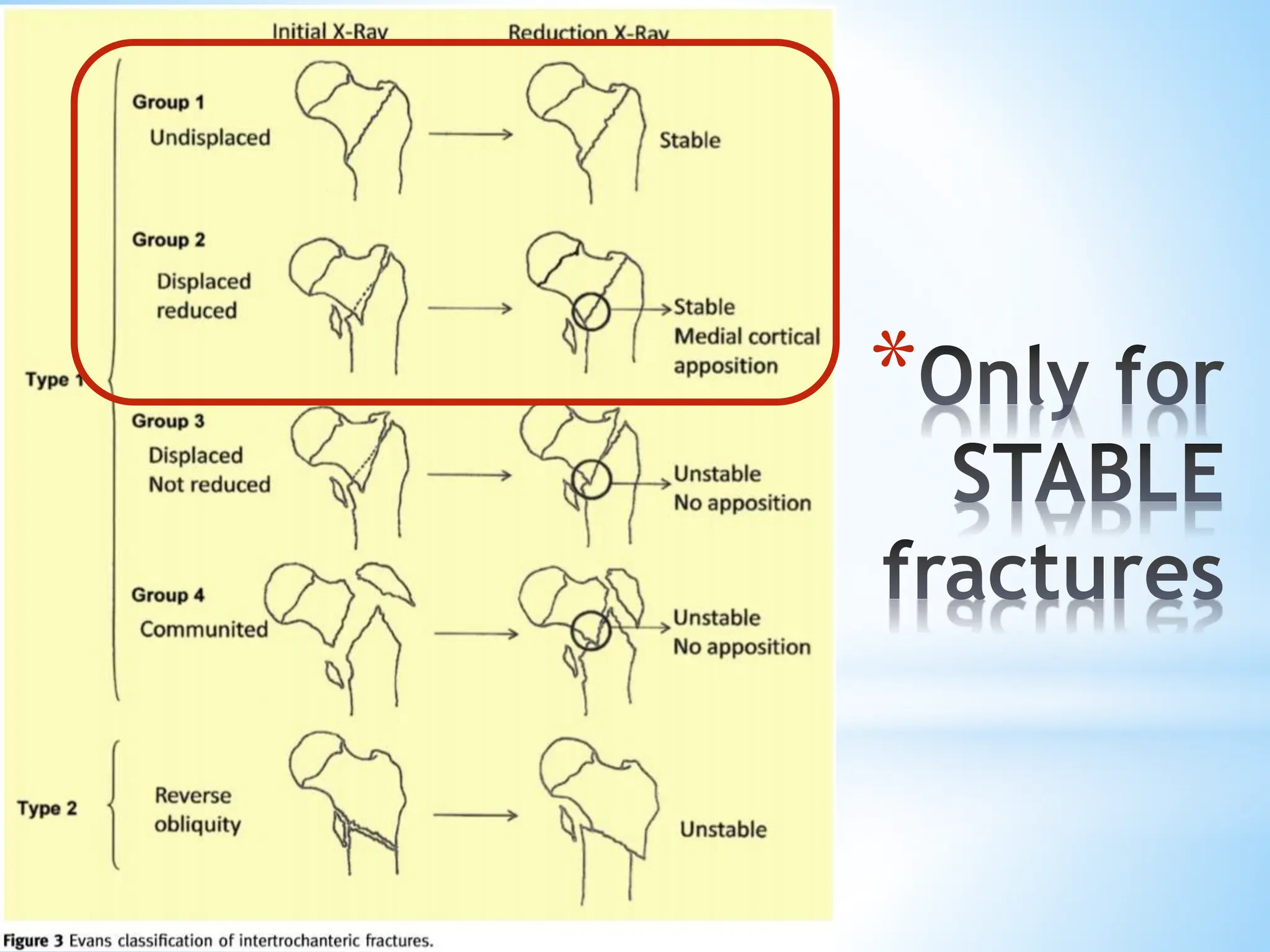 Dhs Principles DHS principles Biomechanics presentation.pdf