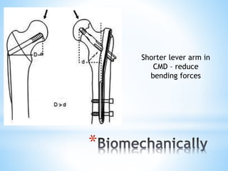 Dhs Principles DHS principles Biomechanics presentation.pdf