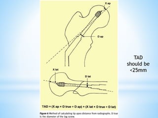 DHS principles Biomechanics presentation.pdf