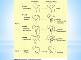 Dhs Principles DHS principles Biomechanics presentation.pdf