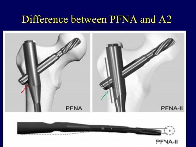 Pfn vs pfna 2 thesis 08 image