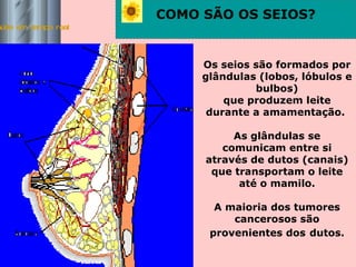 Saúde em tempo real COMO SÃO OS SEIOS? Os seios são formados por glândulas (lobos, lóbulos e bulbos) que produzem leite durante a amamentação.  As glândulas se comunicam entre si através de dutos (canais) que transportam o leite até o mamilo. A maioria dos tumores cancerosos são provenientes dos   dutos. Lobos,  lóbulos e  bulbos Gordura costelas Dutos 