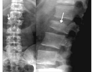 Actualización en Radiología del esqueleto | PPT