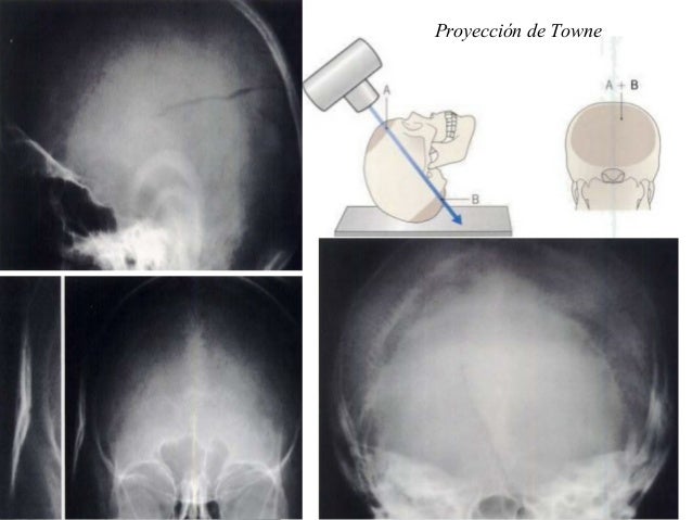 Actualización en Radiología del esqueleto