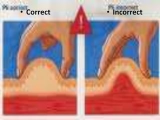 • Correct   • Incorrect
 