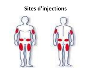 Sites d’injections
 