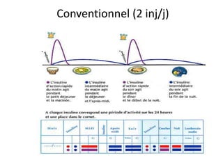 Conventionnel (2 inj/j)
 