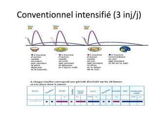 Conventionnel intensifié (3 inj/j)
 