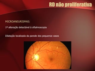 RD não proliferativa  MICROANEURISMAS: 1ª alteração detectável à oftalmoscopia Dilatação localizada da parede dos pequenos vasos 