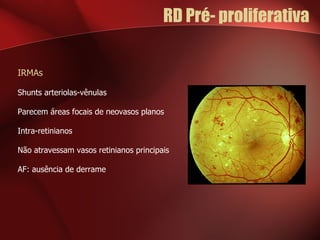 RD Pré- proliferativa  IRMAs Shunts arteriolas-vênulas Parecem áreas focais de neovasos planos Intra-retinianos Não atravessam vasos retinianos principais AF: ausência de derrame 