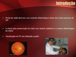 Introdução Perda da visão deve-se a um controle oftalmológico tardio dos sinais precoces de DM A chave para preservação da visão num doente diabético é o exame oftalmológico de rotina Visualização do FO sob dilatação pupilar 