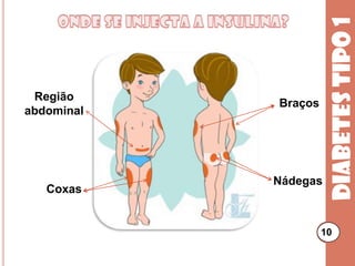 Como se usa a insulina?8O tratamento com insulina é feito através de injecção na gordura por baixo da pele (subcutânea).Diabetes tipo 18