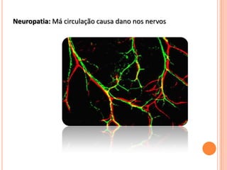 Coma hiperglicêmicoDiabetes Tipo IO tratamento deste tipo de diabetes inclui frequentes injeções de insulina como rotina para suprir a falta desta, que o corpo não consegue produzir.Não há cura para diabetes do tipo I; transplante de rim e pâncreas pode aliviar os sintomas, mas o tratamento com medicação tem de ser mantido por toda a vida, para evitar a rejeição dos órgãos.