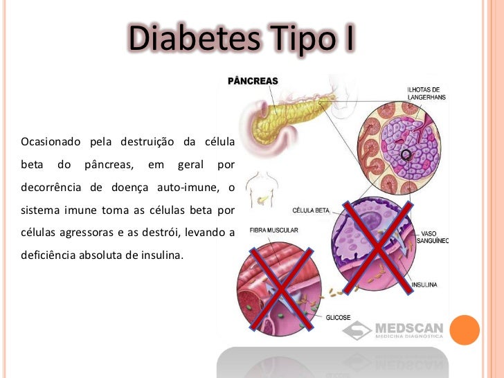 Glucagon And Diabetes Related Keywords - Glucagon And Glucagon And Diabetes Related Keywords - Glucagon And