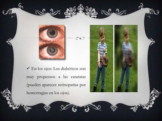  En los ojos: Los diabéticos son
muy propensos a las cataratas
(pueden aparecer retinopatías por
hemorragias en los ojos).
 