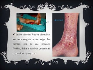  En las piernas: Pueden obstruirse
los vasos sanguíneos que irrigan las
piernas,   por   lo   que    produce
frialdad, dolor al caminar , úlceras &
en ocasiones gangrena.
 