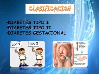 •DIABETES TIPO I
•DIABETES TIPO II
•DIABETES GESTACIONAL
 