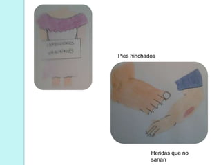 Pies hinchados




            Heridas que no
            sanan
 