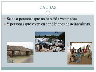 CAUSAS

 Se da a personas que no han sido vacunadas
 Y personas que viven en condiciones de acinamiento.
 