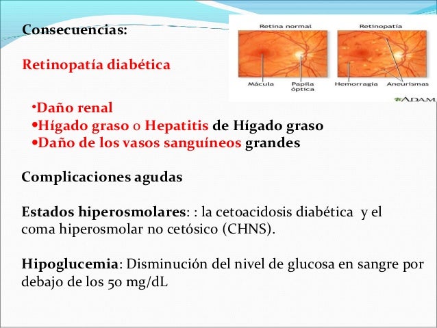 Diabetes Diabetes