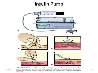 Insulin Pump




03/12/12                  48
 