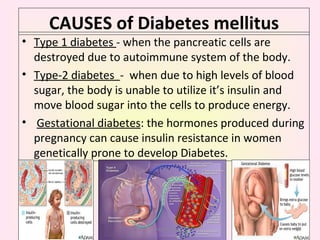 CAUSES of  Diabetes mellitus Type 1 diabetes  - when the pancreatic cells are destroyed due to autoimmune system of the body. Type-2 diabetes  -  when due to high levels of blood sugar, the body is unable to utilize it’s insulin and move blood sugar into the cells to produce energy. Gestational diabetes : the hormones produced during pregnancy can cause insulin resistance in women genetically prone to develop Diabetes. Dr. Sunita Gupta 