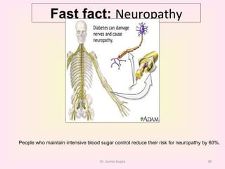 Fast fact:  Neuropathy Dr. Sunita Gupta People who maintain intensive blood sugar control reduce their risk for neuropathy by 60%.   