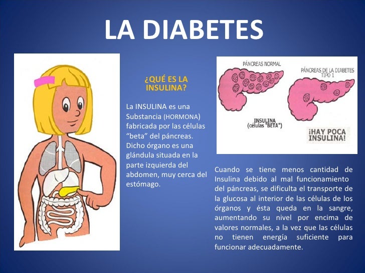 Diabetes en la infancia Diabetes en la infancia