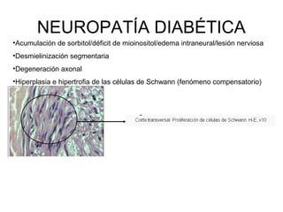NEUROPATÍA DIABÉTICA
•Acumulación de sorbitol/déficit de mioinositol/edema intraneural/lesión nerviosa
•Desmielinización segmentaria
•Degeneración axonal
•Hiperplasia e hipertrofia de las células de Schwann (fenómeno compensatorio)

 
