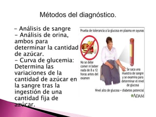 - Análisis de sangre 
- Análisis de orina, 
ambos para 
determinar la cantidad 
de azúcar. 
- Curva de glucemia: 
Determina las 
variaciones de la 
cantidad de azúcar en 
la sangre tras la 
ingestión de una 
cantidad fija de 
azúcar. 
 