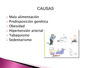  Mala alimentación 
 Predisposición genética 
 Obesidad 
 Hipertensión arterial 
 Tabaquismo 
 Sedentarismo 
 
