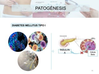 PATOGÉNESIS
DIABETES MELLITUS TIPO I
INSULIN
A Célula
Beta
10
 