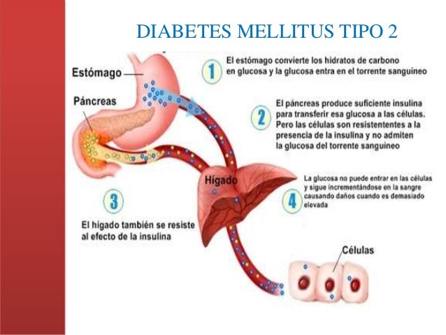 Proyecto Integrador de Saberes ~ Diabetes Mellitus tipo II Proyecto Integrador de Saberes ~ Diabetes Mellitus tipo II