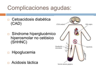 Complicaciones agudas:
 Cetoacidosis diabética
(CAD)
 Síndrome hiperglucémico
hiperosmolar no cetósico
(SHHNC)
 Hipoglucemia
 Acidosis láctica
 