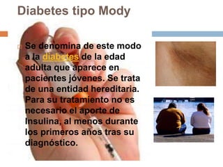 Diabetes tipo Mody
 Se denomina de este modo
a la diabetes de la edad
adulta que aparece en
pacientes jóvenes. Se trata
de una entidad hereditaria.
Para su tratamiento no es
necesario el aporte de
Insulina, al menos durante
los primeros años tras su
diagnóstico.
 