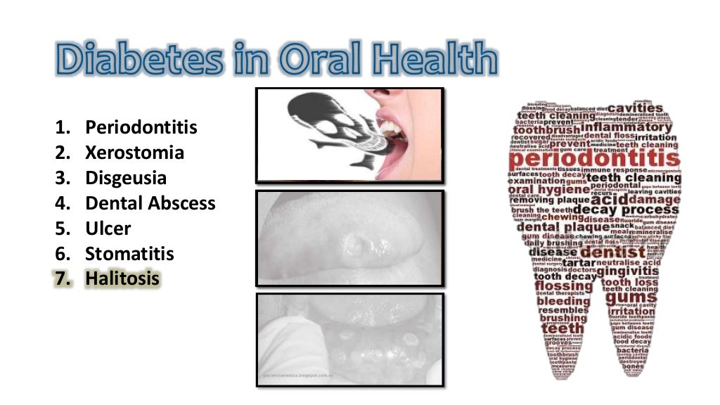 Diabetes and oral problems