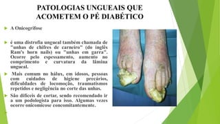 PATOLOGIAS UNGUEAIS QUE
ACOMETEM O PÉ DIABÉTICO
 A Onicogrifose
 é uma distrofia ungueal também chamada de
"unhas de chifres de carneiro" (do inglês
Ram's horn nails) ou "unhas em garra".
Ocorre pelo espessamento, aumento no
comprimento e curvatura da lâmina
ungueal.
 Mais comum no hálux, em idosos, pessoas
com cuidados de higiene precários,
dificuldades de locomoção, traumatismos
repetidos e negligência no corte das unhas.
 São difíceis de cortar, sendo recomendado ir
a um podologista para isso. Algumas vezes
ocorre onicomicose concomitantemente.

 
