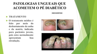 PATOLOGIAS UNGUEAIS QUE
ACOMETEM O PÉ DIABÉTICO
 TRATAMENTO
 O tratamento médico é
feito por meio do
desbastamento da unha
e da matriz, indicada
para pacientes jovens,
pois estes normalmente
apresentam boa
circulação.
 