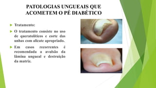 PATOLOGIAS UNGUEAIS QUE
ACOMETEM O PÉ DIABÉTICO
 Tratamento:
 O tratamento consiste no uso
de queratolíticos e corte das
unhas com alicate apropriado.
 Em casos recorrentes é
recomendada a avulsão da
lâmina ungueal e destruição
da matriz.
 