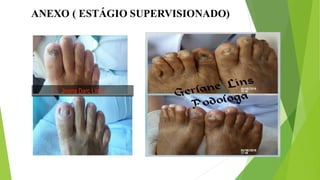 ANEXO ( ESTÁGIO SUPERVISIONADO)
 