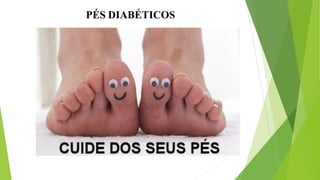 PÉS DIABÉTICOS
 