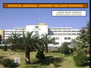 HOSPITAL REGIONAL HONORIO DELGADO ESPINOZA
JAMES MEZA VARGAS
MR GINECOLOGIA Y OBSTETRICIA
 