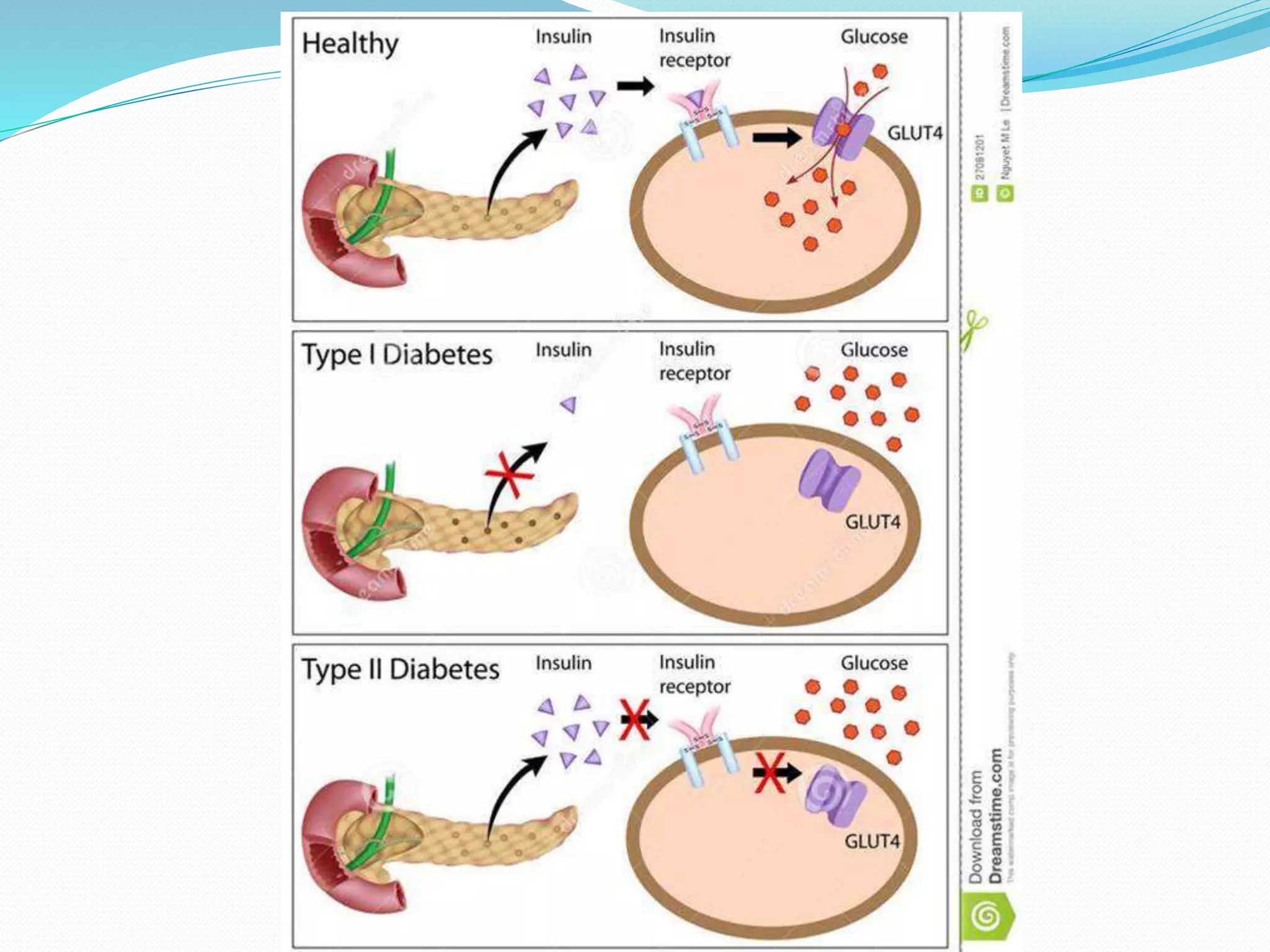 Insulin and Oral Hypoglycemics | PPTX